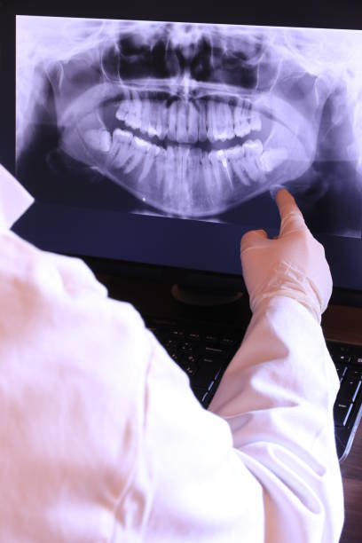 Best Emergency Wisdom Teeth Removal in Dimmitt, TX