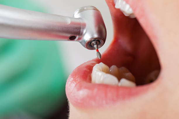 Best Emergency Treatment for Toothache in Dimmitt, TX